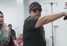 Ibu Tiri NS Bantah Luka Melepuh Sebab Air Panas, Netizen: Apa Guna Adem Sari?